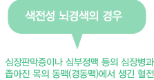 색전성 뇌경색의 경우