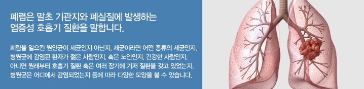  폐렴은 말초 기관지와 폐실질에 발생하는 염증성 호흡기 질환을 말합니다. 폐렴을 일으킨 원인균이 세균인지 아닌지, 세균이라면 어떤 종류의 세균인지, 병원균에 감염된 환자가 젊은 사람인지, 혹은 노인인지, 건강한 사람인지, 아니면 원래부터 호흡기 질환 혹은 여러 장기에 기저 질환을 갖고 있었는지, 병원균은 어디에서 감염되었는지 등에 따라 다양한 모양을 볼 수 있습니다. 