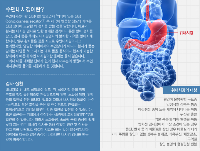 수면내시경이란?  수면내시경이란 진정제를 맞으면서 의식이 있는 진정 (consciousness sedation), 즉 자극에 반응할 정도의 가벼운 진정 상태에 도달한 채 검사를 받는 것을 말합니다. 이로써 환자는 내시경 검사로 인한 불쾌한 감각이나 통증 없이 검사를 받고, 검사 종류 후에도 내시경검사의 불쾌한 기억을 없어지게 합니다. 일부 환자들은 잠을 자므로 수면내시경이라고 불러왔지만, 엄밀한 의미에서의 수면상태가 아니라 환자가 묻는 말에는 대답을 하고 시키는 대로 몸을 움직이나 협조가 가능한 상태이기 때문에 수면 내시경이란 용어는 옳지 않습니다. 그러나 이를 대체할 단어가 없어 현재 대부분의 병원에서 수면 내시경이란 용어를 사용하게 된 것입니다. <br />검사 질환은 내시경을 위 내로 삽입하여 식도, 위, 십이지장 등의 점막 구조를 직접 육안적으로 관찰함으로써 위염, 소화성 궤양, 위암 등의 질환을 진단 합니다. 필요에 따라서 내시경을 통하여 1~2 mm정도의 작은 조직을 뜯은 후 현미경으로 관찰하는 조직생검으로 위암을 비롯한 각종 질환을 확진할 수 있습니다. 또한 최근에는 위내에서 성장하는 세균(헬리코박터)감염유무도 확인할 수 있습니다. 따라서 소화불량, 속쓰림 등의 증상이 쉽게 낫지 않는 경우 내시경 검사를 통해 정확한 원인 및 진단을 하고 이를 바탕으로 적절한 치료를 하는 것이 필수적입니다. 이밖에도 다음과 같은 증상이 나타나면 내시경 검사를 받는 것이 바람직합니다. 위내시경의 대상은 원인이 불명확한 구토증 만성적인 상복부 통증 야간취침 중에 또는 새벽에 나타나는 복통 위장관 출혈  약물 복용에 의해 발생된 복통  방사선 검사상에서 이상 소견이 있는 경우 동전, 반지 등의 이물질을 삼킨 경우 이물질의 제거  기타 뚜렷한 원인이 없는 상복부 불쾌감, 식욕부진, 체중감소, 구역질 원인 불명의 철결핍성 빈혈