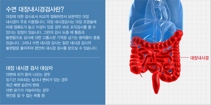 수면 대장내시경검사란? 대장에 대한 검사로서 비교적 정확하면서 보편적인 대장 내시경이 주로 이용됩니다. 대장 내시경검사는 대장 조영술에 비해 정확도가 높고 이상이 있을 경우 바로 조직검사를 할 수 있다는 장점이 있습니다. 그런데 검사 도중 에 통증과 불편함으로 검사에 대한 고통스런 기억을 남기는 환자들이 종종 있습니다. 그러나 수면 내시경 검사는 일반 내시경 검사의 불편함을 줄여주어 편안히 내시경 검사를 받으실 수 있습니다. 대장 내시경 검사 대상자는 대변에 피가 묻어 나오는 경우,장기간 지속되는 설사나 변비가 있는 경우,최근 배변 습관의 변화 ,대변 굵기가 가늘어지는 경우 ,원인을 알 수 없는 복통 등 