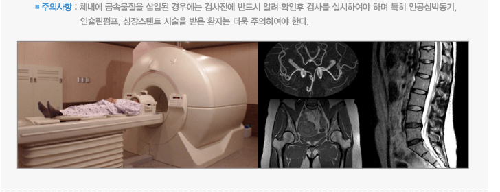 주의사항 : 체내에 금속물질을 삽입된 경우에는 검사전에 반드시 알려 확인후 검사를 실시하여야 하며 특히 인공심박동기,인슐린펌프, 심장스텐트 시술을 받은 환자는 더욱 주의하여야 한다.