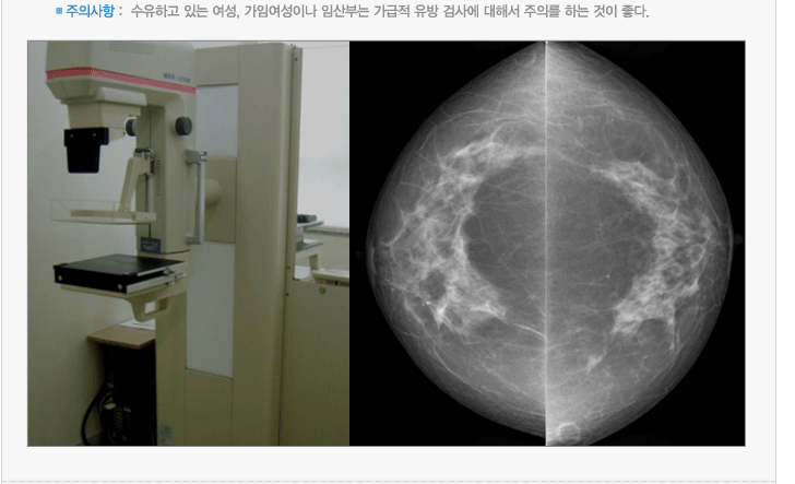 주의사항 :  수유하고 있는 여성, 가임여성이나 임산부는 가급적 유방 검사에 대해서 주의를 하는 것이 좋다.