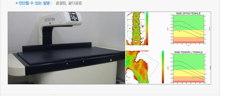 진단할 수 있는 질병 :   골결핍, 골다공증